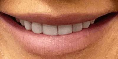Bright and healthy smile
