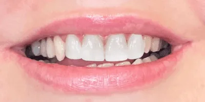 Radiant smile showcasing dental health