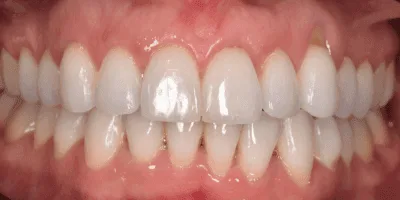 Healthy teeth