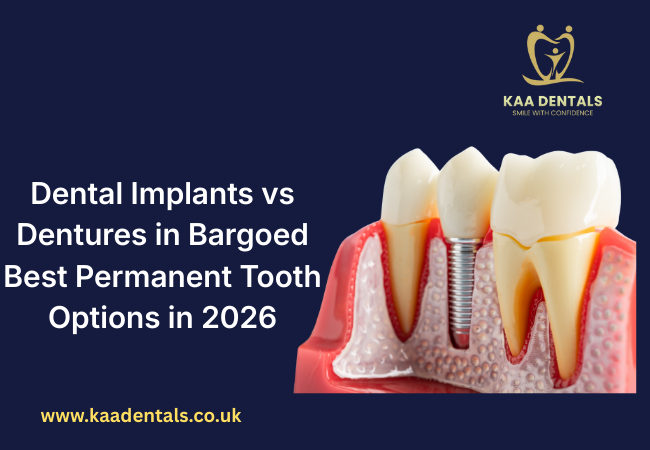 Dental implant and natural teeth showing implants vs dentures in Bargoed