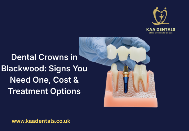 Ceramic dental crown used to repair a broken tooth