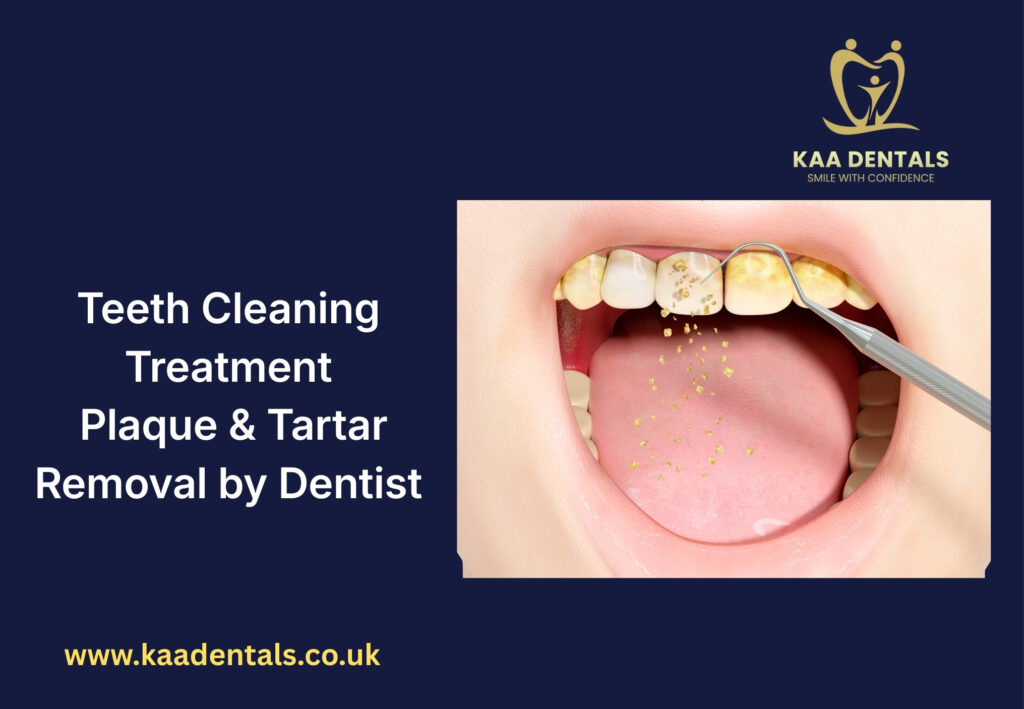 Plaque and tartar removal treatment by dentist during professional teeth cleaning in Pontypridd
