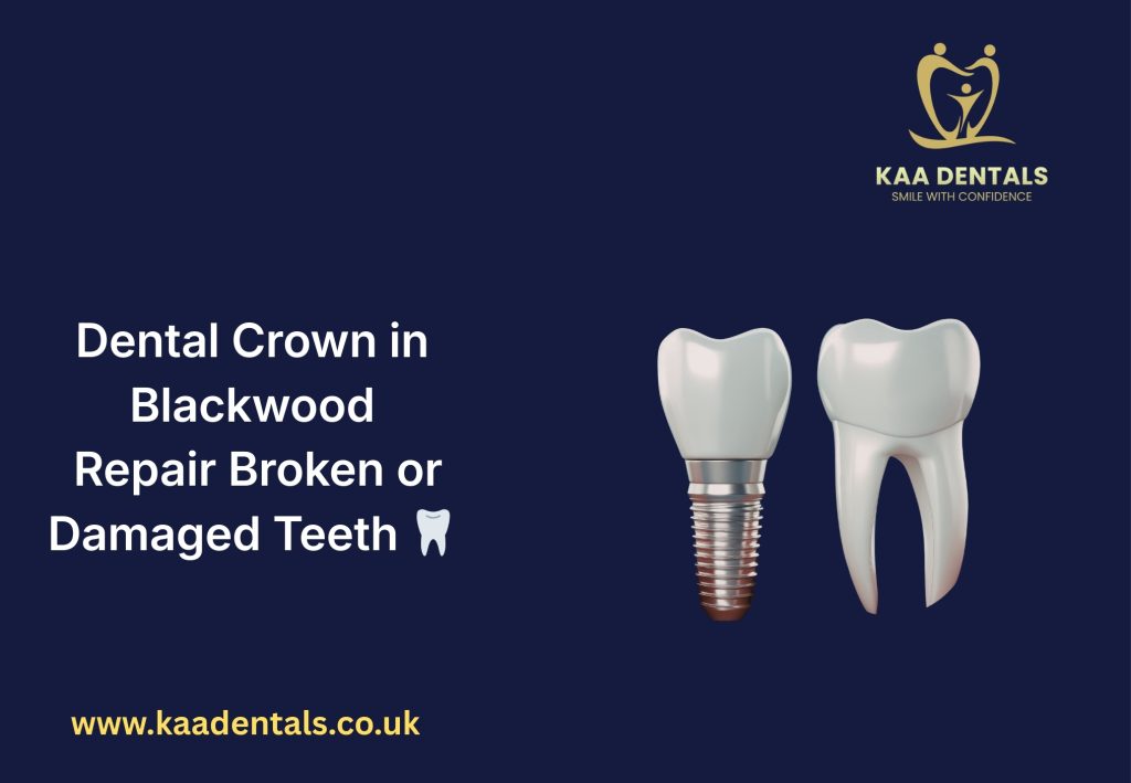 Dental crown treatment in Blackwood restoring a broken or damaged tooth with a modern porcelain crown