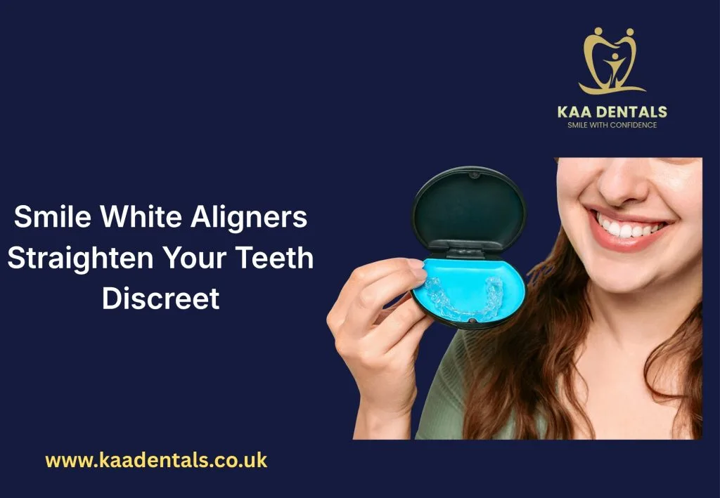 Smile White aligners treatment for teeth straightening with clear aligners