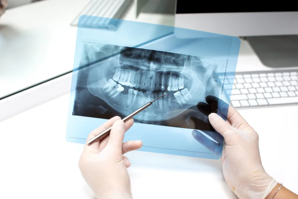 xray