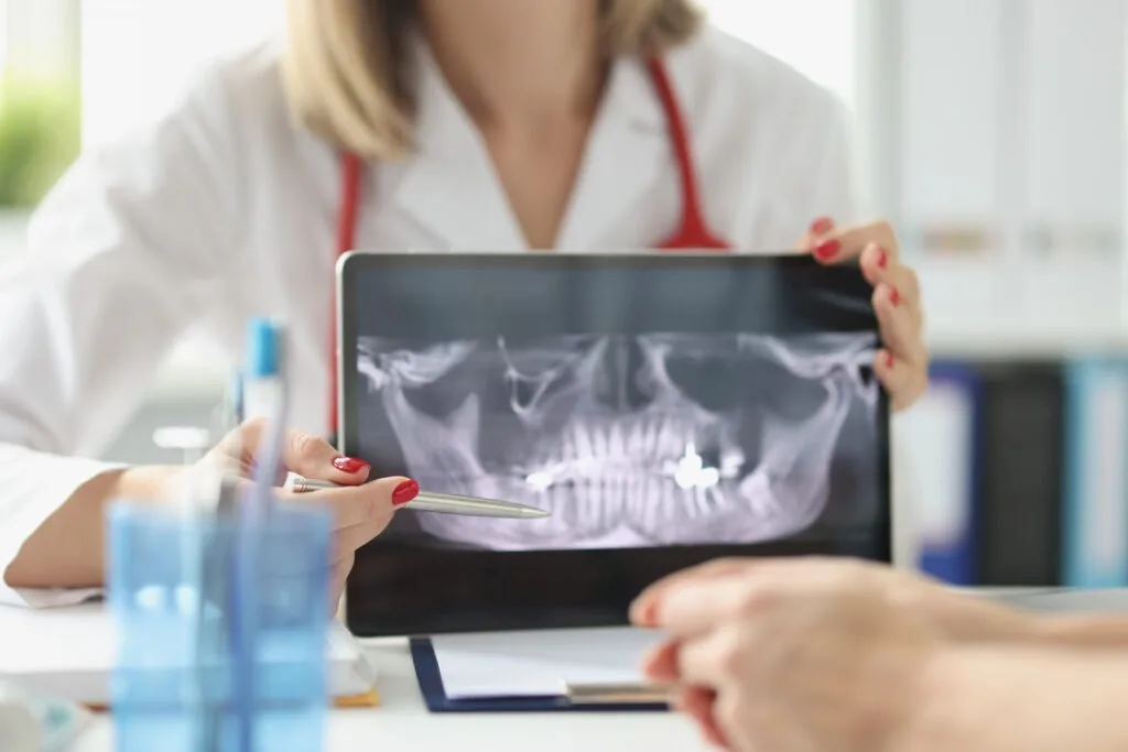 xray