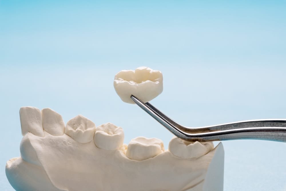 dental crown